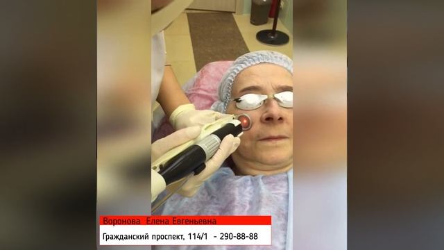 Лазерное удаление сосудистой сеточки в клинике 