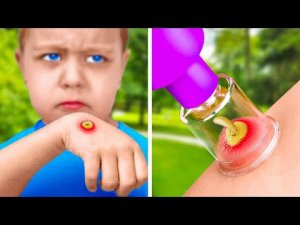 ЭКСТРЕННЫЕ ПРИЕМЫ И СОВЕТЫ ПО ОКАЗАНИЮ ПЕРВОЙ ПОМОЩИ, КОТОРЫЕ ДОЛЖЕН ЗНАТЬ КАЖДЫЙ РОДИТЕЛЬ.