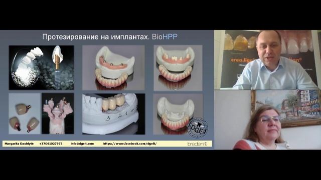 Особенности техники свободного нанесения композиционного материала. смотреть онлайн