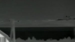 Фотографу пересадили вместо глаза камеру