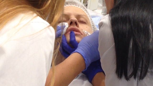 АирисКом; обучение студентов. Первая практика учеников; филлеры носогубная складка