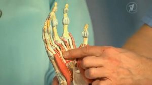 Контрактура Дюпюитрена. От чего скрючиваются пальцы