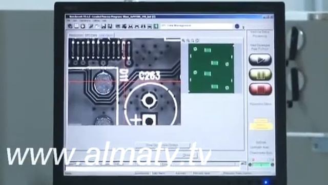 Қазақстандықтар өкпе ауыстырып салуға мүмкіндік алды смотреть онлайн
