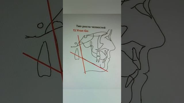 ТРГ по Шварцу, метод Твида, Ди Паоло (часть 1) смотреть онлайн