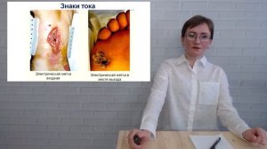 Двести двадцать и больше – как помочь ребенку при ударе током?