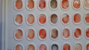 Методика определения групп крови