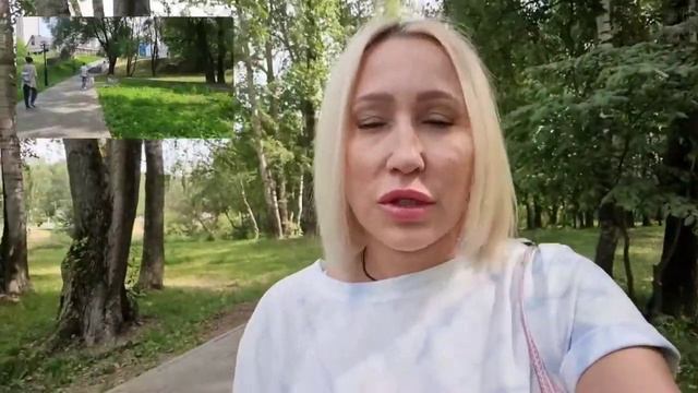 Контурная пластика . Увеличение скул филлером.