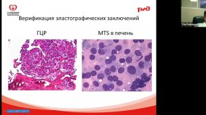 Методика Эластографии Болоцков А С
