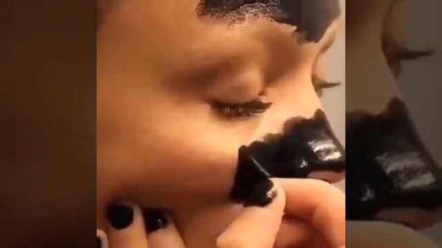 Нейрофиброматоз. Как Распознать Опасные Пятна На Коже [Темные Точки На Коже] смотреть онлайн