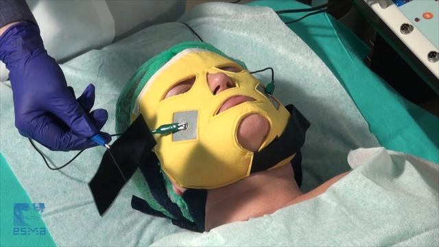 Проведение процедуры ионофореза при помощи токопроводящей маски ЭСМА смотреть онлайн