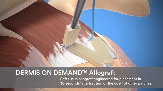 DePuy Synthes VUE Arthroscopic Tower With PUREVUE 4K Visualization System