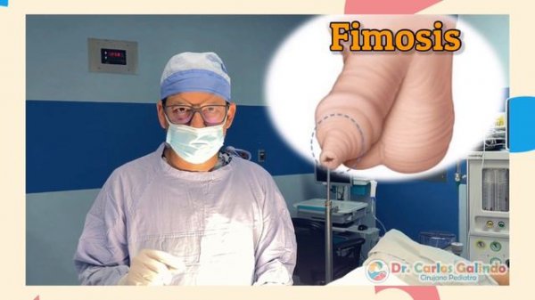 Como detectar FIMOSIS PATOLÓGICA