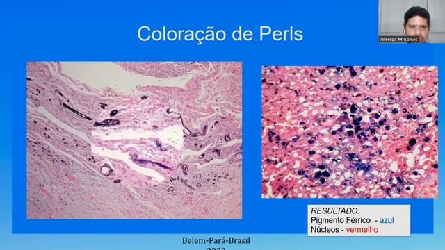 [CORTE] Coloração de Perls | Imersão PEESB Coloração Especial смотреть онлайн