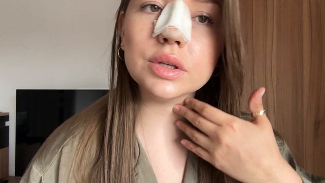 РИНОСЕПТОПЛАСТИКА / 2 часть, реабилитация дома + советы, как проходили дни в другой стране - Ереван смотреть онлайн