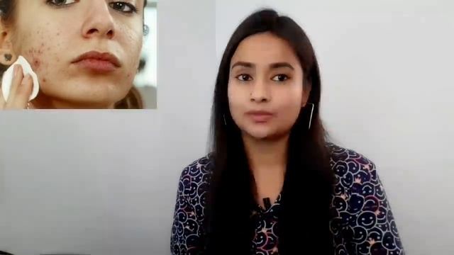 Salicylic Acid Ice Cream Face Mask | Honest Review | The Truth Of Viral Video смотреть онлайн