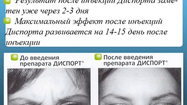 Диспорт в Омске - Шарман