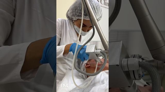 Лазерная шлифовка лица. Лазерная Co2 шлифовка лица в борьбе с воспарения и постакне смотреть онлайн