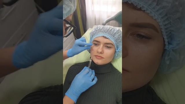 Заполнение носослезной борозды смотреть онлайн