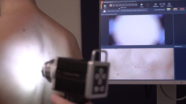 Родинки под контролем смотреть онлайн