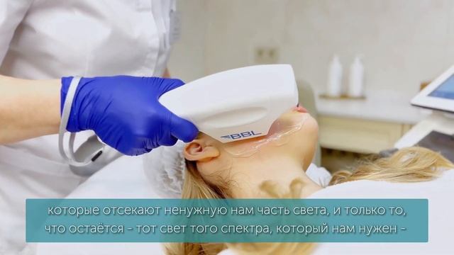 ФОТООМОЛОЖЕНИЕ BBL