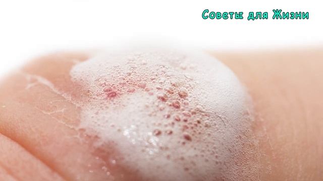 НЕ ВЗДУМАЙТЕ ПРИНИМАТЬ ПЕРЕКИСЬ ВОДОРОДА – «Лечение» перекисью водорода и другие нелепые мифы смотреть онлайн