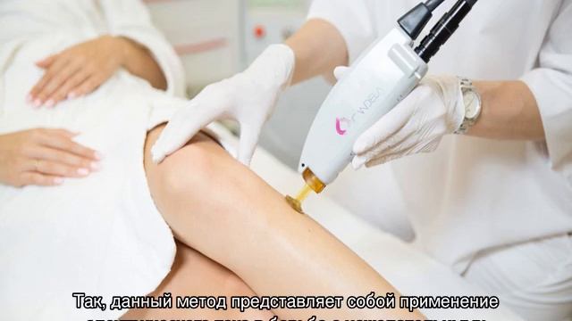 Виды лазерной эпиляции смотреть онлайн