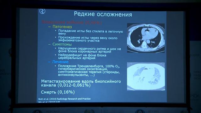 Буровик И.А. - Интервенционные методики под КТ-навигацией смотреть онлайн