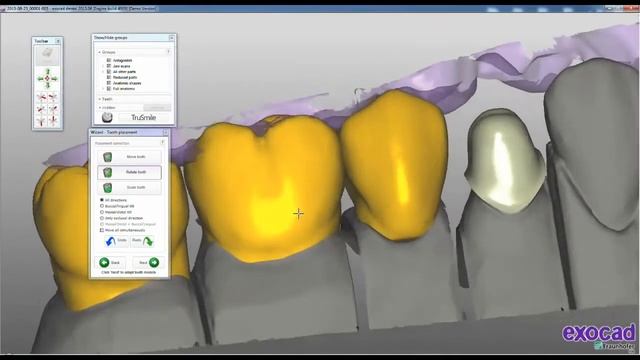 EXOCAD Design Demo Shining3D DentalCAD смотреть онлайн