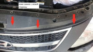 Снятие передних фар Hunday Grand Starex (Хюндай Гранд Старекс) 2008г. 2.5 TD