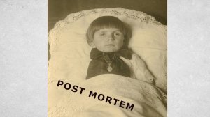 «Фотография, где я не улыбаюсь».
