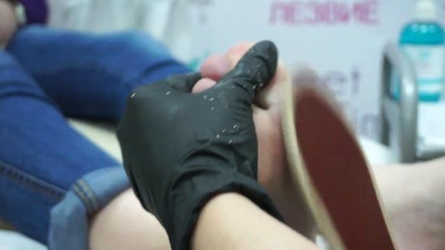 Процедура педикюра с использованием 'Жидкого лезвия - пенного экспресс размягчителя' Domix. смотреть онлайн