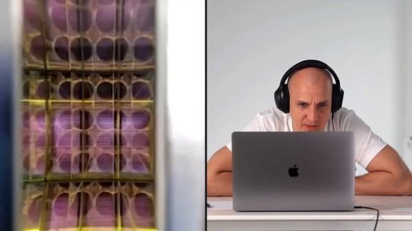 ЭТО ДОЛЖЕН ЗНАТЬ КАЖДЫЙ владелец диодного лазерного аппарата Soprano Ice. Обучение от разработчика.