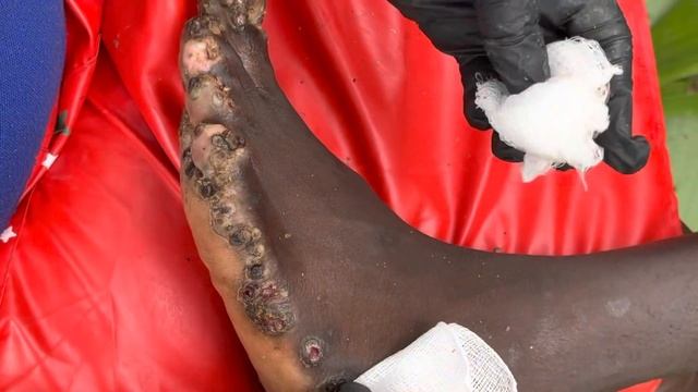 Jigger digging Buda’s left foot - subscribe now @riseupsociety.net to watch FULL VIDEO смотреть онлайн