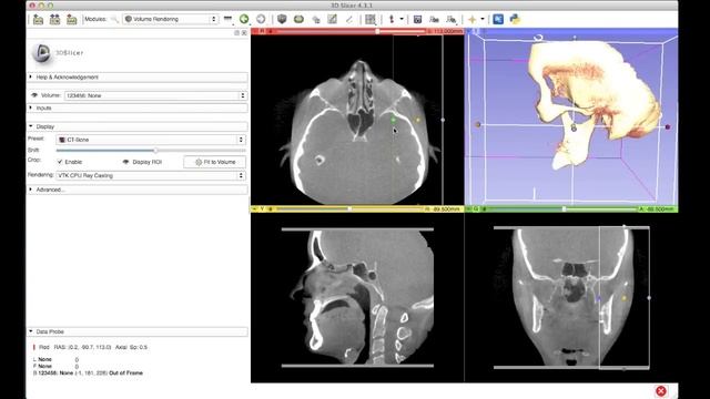 Tutorial: Preparing Data for 3D Printing Using 3D Slicer смотреть онлайн