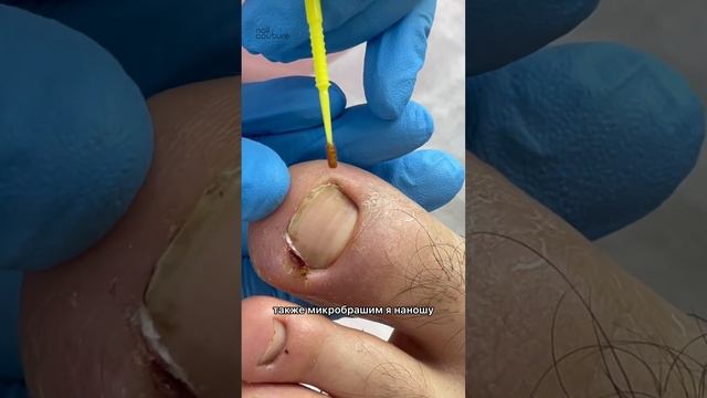 Курсы подологии в Екатеринбурге #курсыпедикюра #педикюр #подология #вросшийноготь #pedicure смотреть онлайн