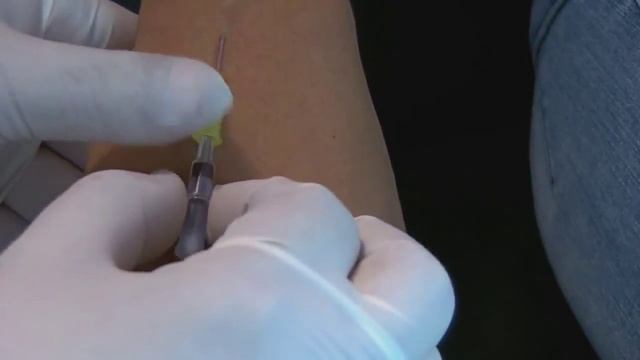 Внутривенная инъекция Инфузия Капельница смотреть онлайн