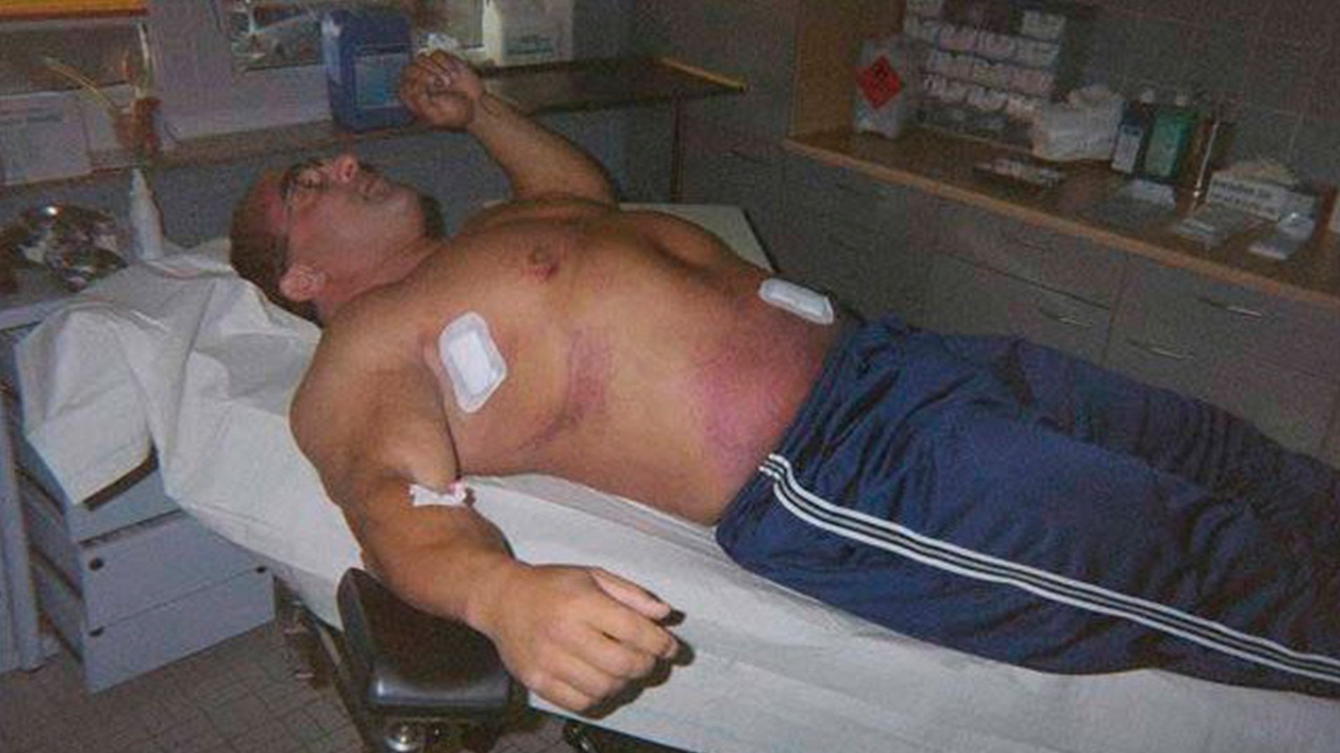 ИСТОЩИЛ ПОЧКИ ХИМИЕЙ. СКОРЫЙ КОНЕЦ НАССЕРА ЭЛЬ СОНБАТИ смотреть онлайн