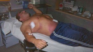 ИСТОЩИЛ ПОЧКИ ХИМИЕЙ. СКОРЫЙ КОНЕЦ НАССЕРА ЭЛЬ СОНБАТИ