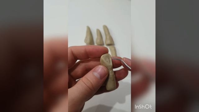 Резцы и клык 4- го сектора( сегмента) смотреть онлайн