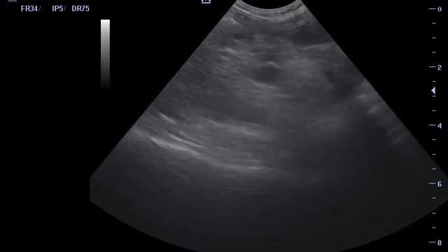 201605071122400021PED смотреть онлайн