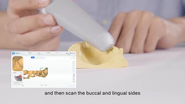 Shining 3D Aoralscan Scanning Skills смотреть онлайн