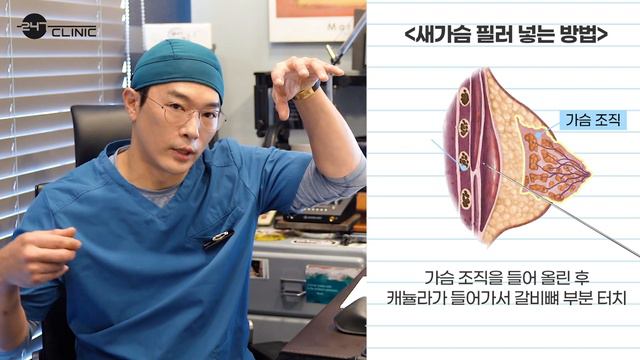 새가슴필러로 가슴골을 만들 수 있을까요? 시술 방법부터 다 알려드려요!! смотреть онлайн