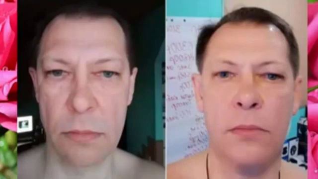 Отличный результат применения Лифтинг-системы "Шарм". смотреть онлайн