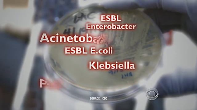 Mutated E-Coli Turned Deadly Superbug смотреть онлайн