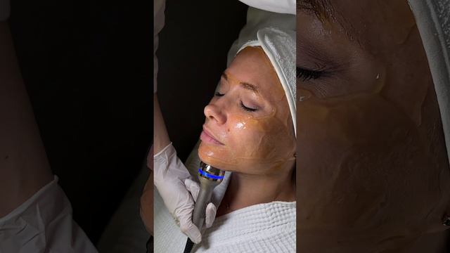 Ультразвуковая программа омоложения Skinova Pro - улучшение кожи на клеточном уровне | клиника GEN87 смотреть онлайн