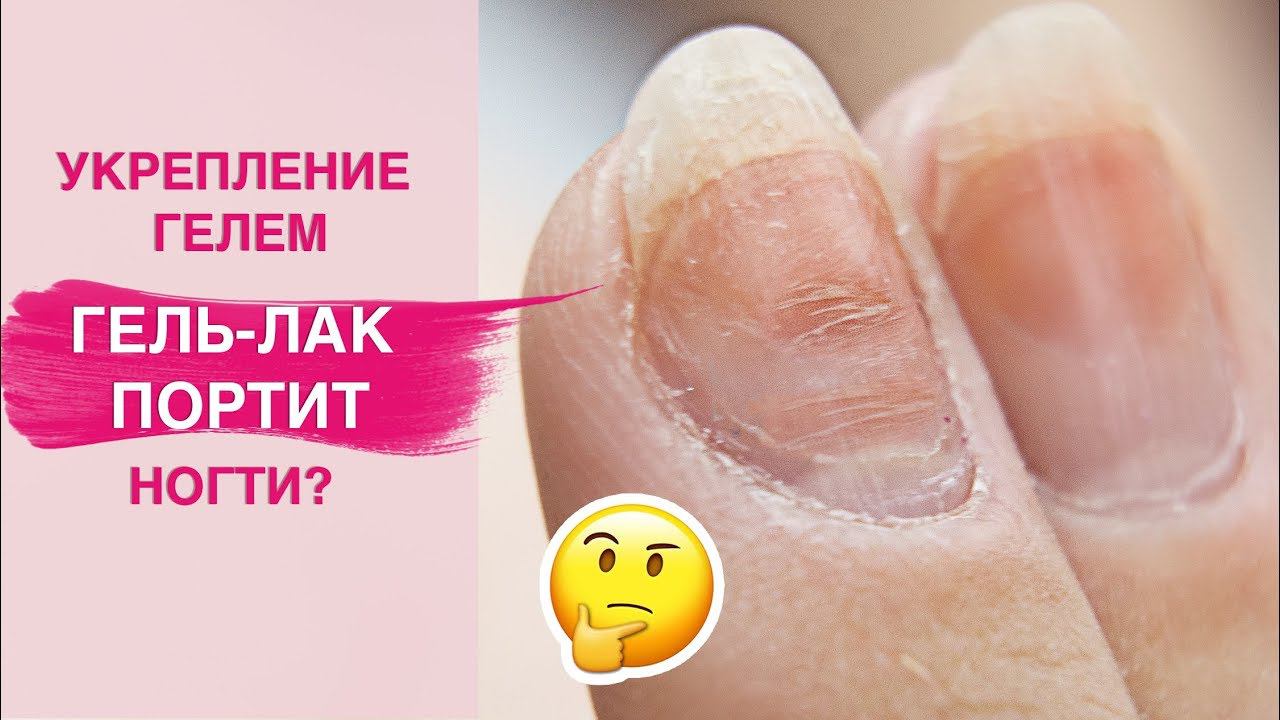 Спасаем ногти | УКРЕПЛЕНИЕ натуральных ногтей гелем смотреть онлайн