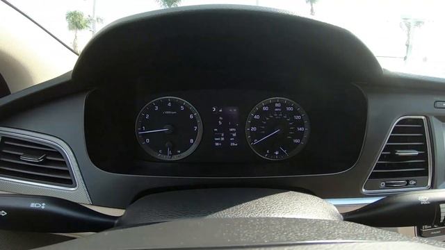 2016 Hyundai Sonata SE Inside Out