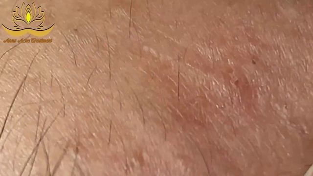 Most Satisfying And Relaxation With An Spa Video #188