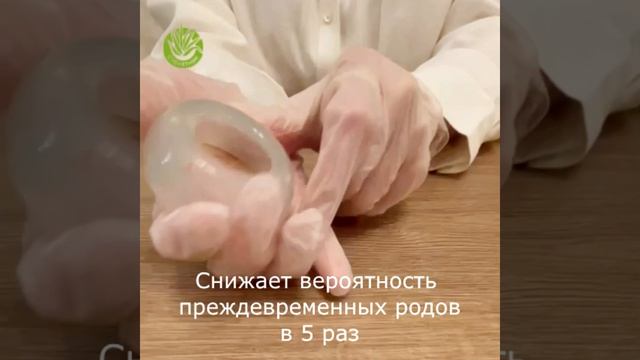 Обзор акушерского пессария Dr.Arabin тип ASQ