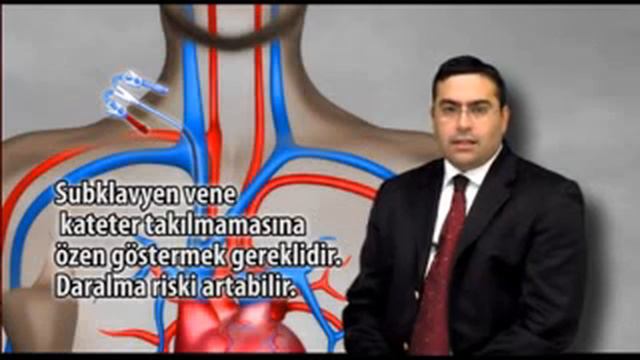 Gemodializ Гемодиализ смотреть онлайн